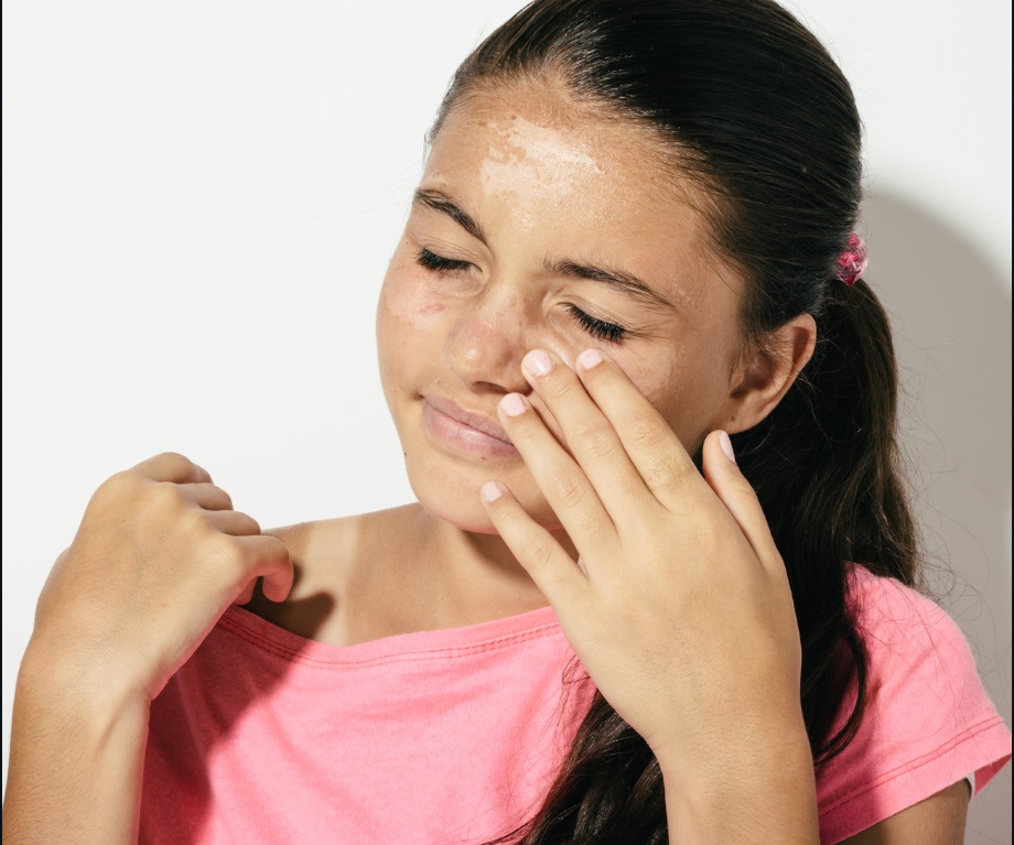 Sunburn: How to Treat and Soothe Sun-Damaged Skin